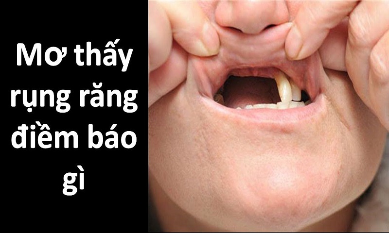 Mơ thấy răng rụng cảnh báo điềm gì, nên đánh con gì trong lô đề?